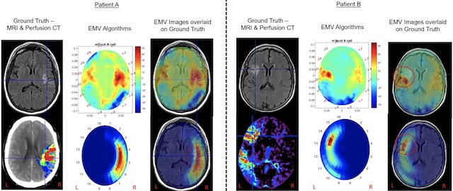 EMVision scan MRI CT image