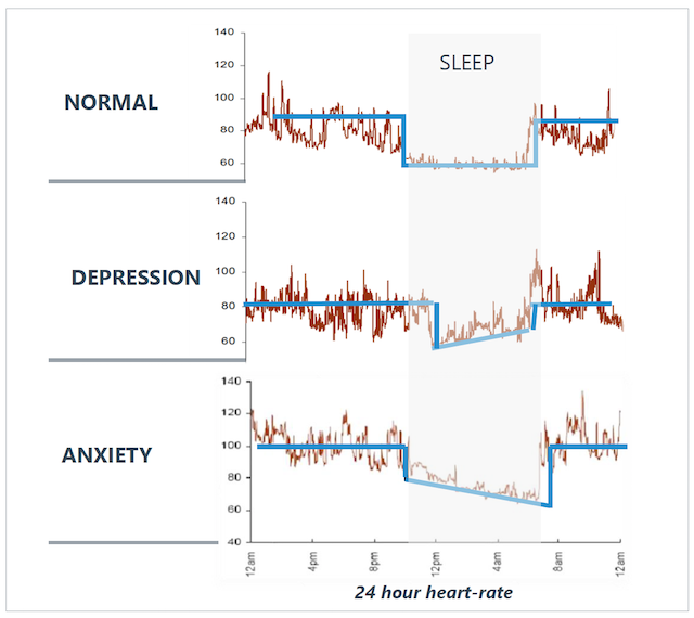 Medibio MEB morphological analysis circadian heart rate mental illness